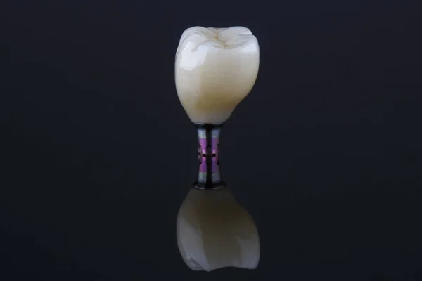 Dental Makro Zdjęcie Wysokiej Jakości Korony Czarnym Szkle Odbiciem — Zdjęcie stockowe
