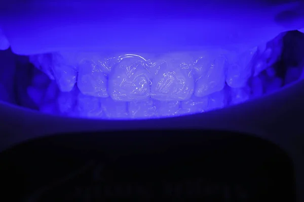 Специальный Процесс Отбеливания Ультрафиолетовых Ламп Зубов Пациентов — стоковое фото