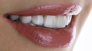 perfect smile of a girl with veneers and beautiful lipstick clipart