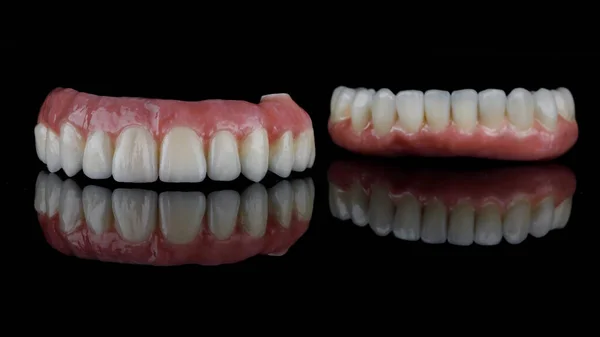 Prótese Dentária Bonita Mandíbula Superior Inferior Feita Cerâmica Alta Qualidade — Fotografia de Stock