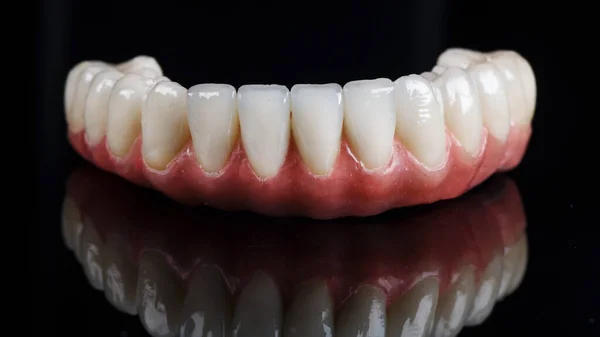 Dentiera Con Gomma Rosa Della Mascella Inferiore Fondo Nero — Foto Stock