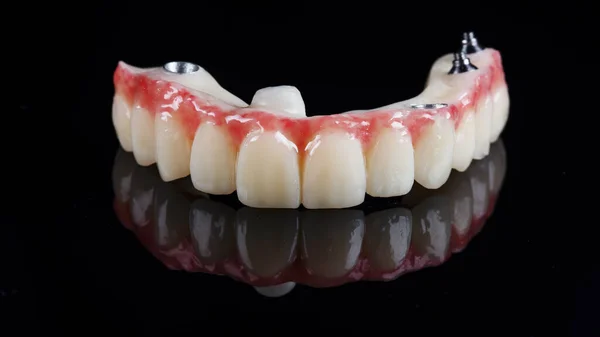 Zęba Szczęki Górnej Czarnym Tle — Zdjęcie stockowe