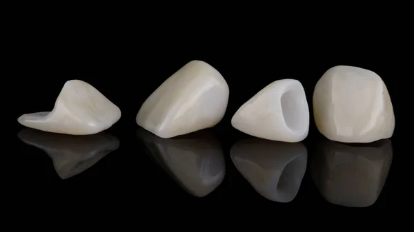 Okleiny Dentystyczne Wykonane Wysokiej Jakości Ceramiki Czarnym Szkle Odbiciem — Zdjęcie stockowe
