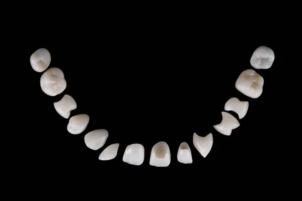 Beautifully Laid Out Dental Veneers Made Ceramic Black Background — Stock Photo, Image