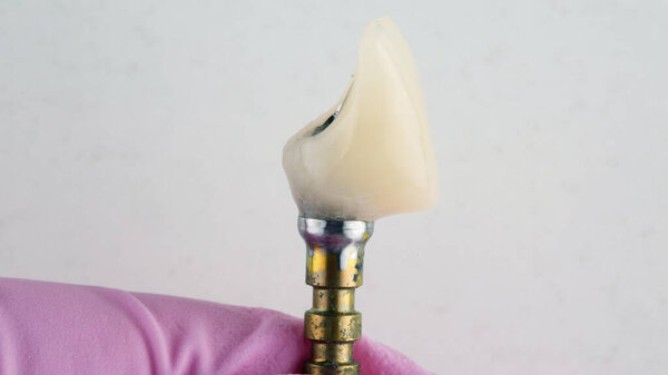 temporary crown made of polymer on a dental stransphere before placing on the patient