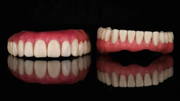 反射のある黒の背景にピンクのガムで上顎と下顎のワックス — ストック写真
