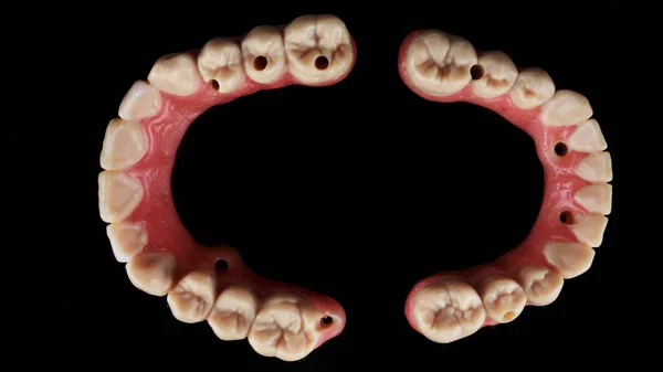 Cera Maxilar Mandibular Com Morfologia Fundo Preto — Fotografia de Stock