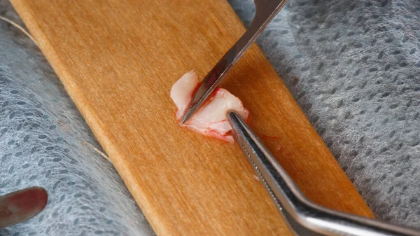 Pedaço Retalho Uma Lâmina Cirurgia Dentária — Fotografia de Stock