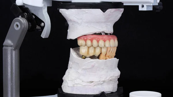 Pembe Sakızlı Üst Çene Protezi Siyah Arkaplandaki Eklem Makinesindeki Modellerde — Stok fotoğraf