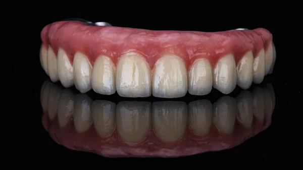 Skvělá Fotografie Keramické Zubní Protézy Horní Čelisti Černém Skle Kreativním — Stock fotografie