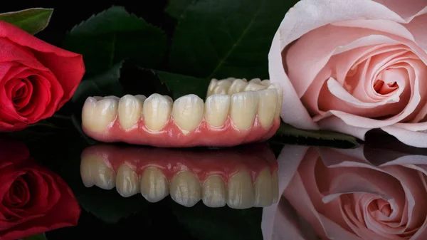 Красивая Зубная Композиция Протеза Верхней Челюсти Цветы Черном Стекле Творческим — стоковое фото