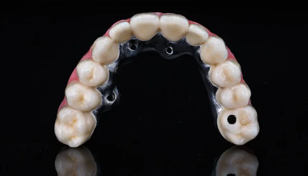 Prótesis Dental Cerámica Metálica Mandíbula Superior Sobre Vidrio Negro —  Fotos de Stock