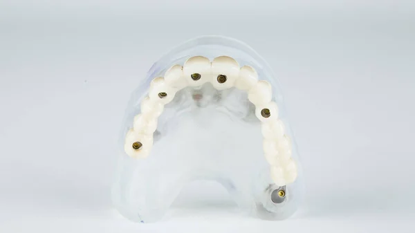 Beyaz Arkaplandaki Modelin Üst Çenesi Için Takma Diş Çiğneme Kısmının — Stok fotoğraf