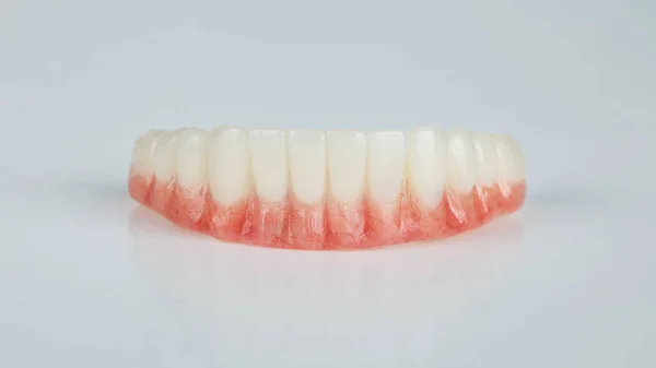 Beyaz Arkaplanda Kırmızı Sakızlı Alt Çenenin Geçici Takma Dişleri — Stok fotoğraf