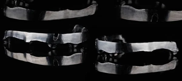 Batonik Tytanowy Protez Dentystycznych Postaci Kolażu Czarnym Szkle Odbiciem — Zdjęcie stockowe