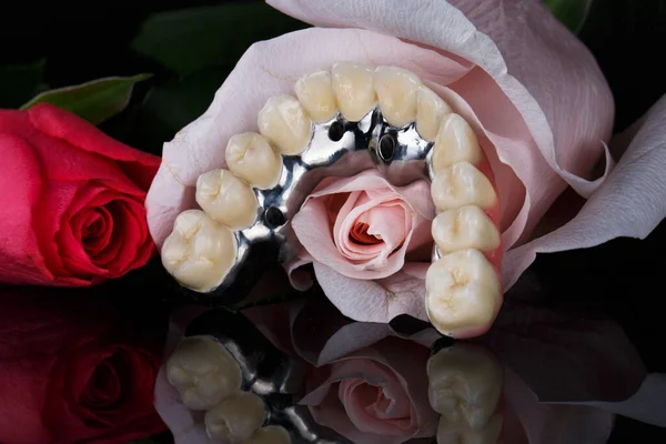 Proteza Stomatologiczna Wykonana Ceramiki Metalu Pięknym Kwiatku Czarnym Tle — Zdjęcie stockowe