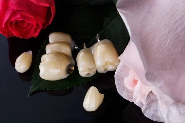 Beautiful Composition Ceramic Dental Crowns Green Leaf Next Flowers — Stock Photo, Image