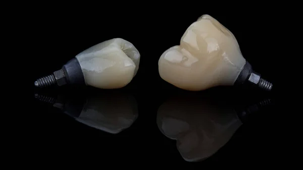 Dos Coronas Dentales Vidrio Negro Con Reflexión Creativa —  Fotos de Stock