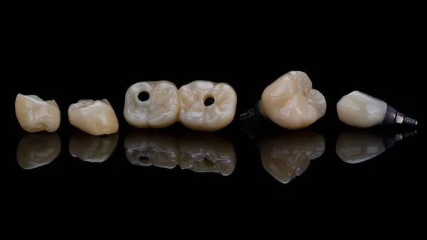 Composición Hermosas Coronas Cerámica Dental Incrustaciones Vidrio Negro Con Reflexión —  Fotos de Stock