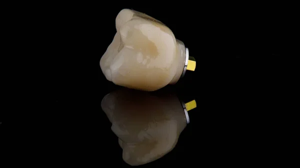Μονή Μασημένη Οδοντωτή Κορώνα Από Ζιργκόν Μαύρο Γυαλί Αντανάκλαση — Φωτογραφία Αρχείου