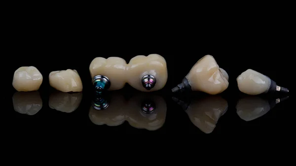 Ceramiczne Korony Dentystyczne Najwyższej Jakości Czarnym Szkle Kreatywnym Odbiciem — Zdjęcie stockowe