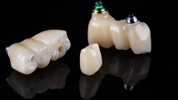 Ceramic Dental Bridges Chewing Area One Crown Black Glass — Stock Photo, Image
