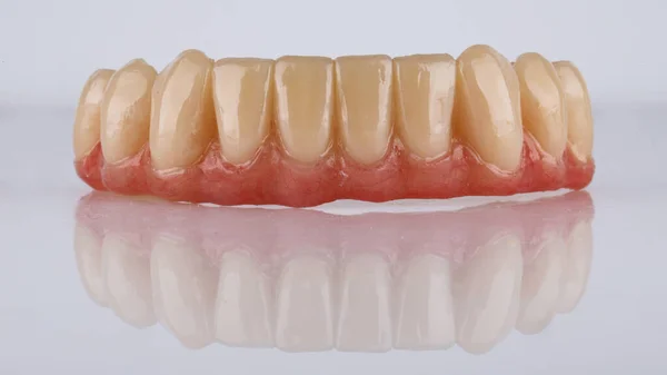 Uitstekende Tandprothese Van Onderkaak Met Kunstmatige Gom Een Witte Achtergrond — Stockfoto