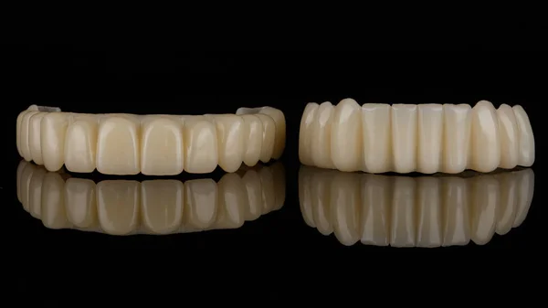 Próteses Dentárias Temporárias Das Mandíbulas Superior Inferior Plástico Moído Polímero — Fotografia de Stock