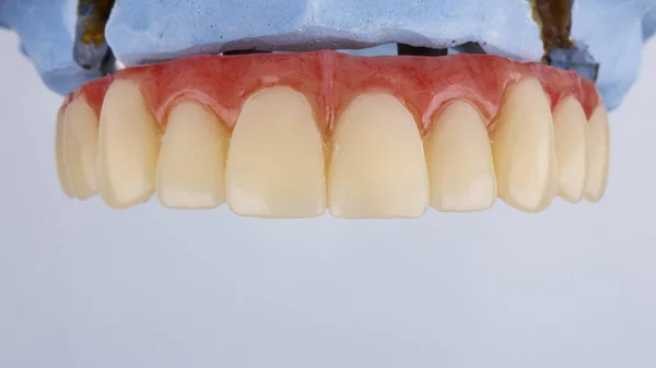 Hermosa Mandíbula Superior Protésica Dental Con Goma Rosa Sobre Fondo —  Fotos de Stock