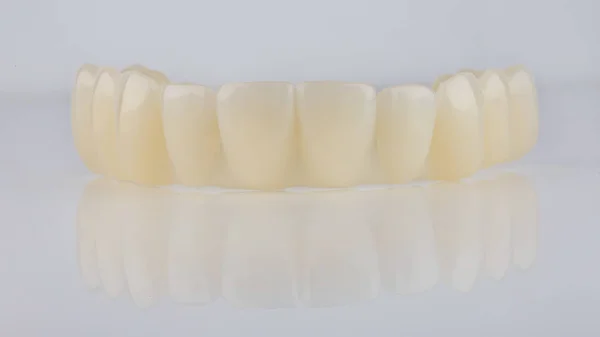 Grande Foto Mandíbula Superior Provese Dental Fundo Branco Com Reflexão — Fotografia de Stock