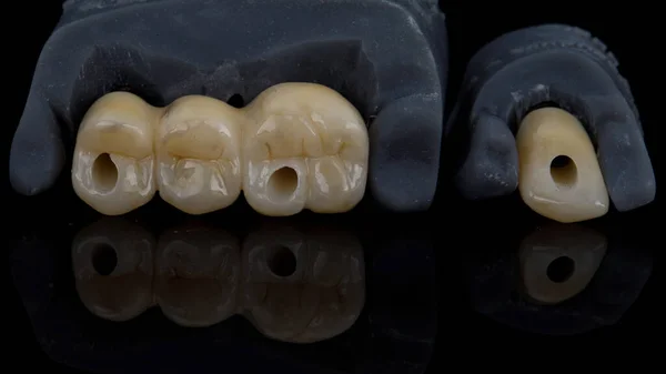 Coroas Dentárias Com Morfologia Zircão Modelos Foto Vidro Preto Com — Fotografia de Stock