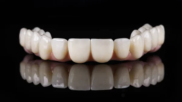 黒ガラスにピンクのガムとジルコンからの歯科補綴物反射 — ストック写真