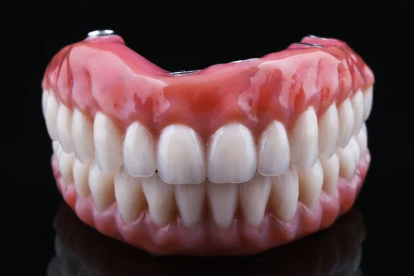 Próteses Dentárias Cerâmicas Feitas Cerâmica Metálica Mordida Fundo Preto — Fotografia de Stock