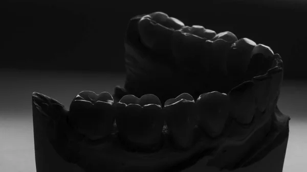 Δημιουργική Φωτογραφία Των Οδοντικών Στεφάνων Ένα Μοντέλο Μαύρο Και Άσπρο — Φωτογραφία Αρχείου