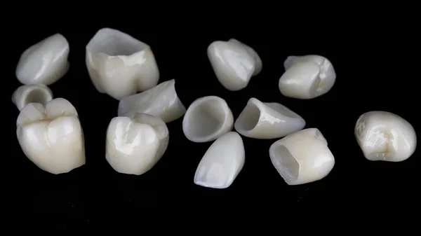 Wysokiej Jakości Korony Ceramiczne Dla Całkowitej Protezy Pacjenta — Zdjęcie stockowe