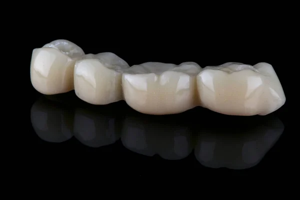 Siyah Arka Planda Polimerden Yapılmış Çiğneme Dişleri Üzerine Geçici Bir — Stok fotoğraf