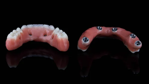 Зубні Протези Нижньої Верхньої Щелепи Зняті Ззаду Чорному Тлі — стокове фото