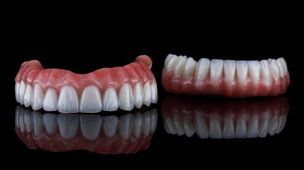 Prótese Dentária Bonita Para Mandíbula Superior Primeiro Plano Filmado Fundo — Fotografia de Stock