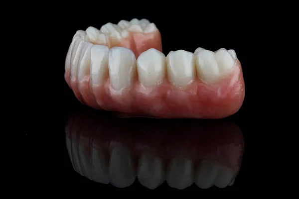 Dental Lower Jaw Prosthesis Pink Gum Black Glass Side View — Stock Photo, Image