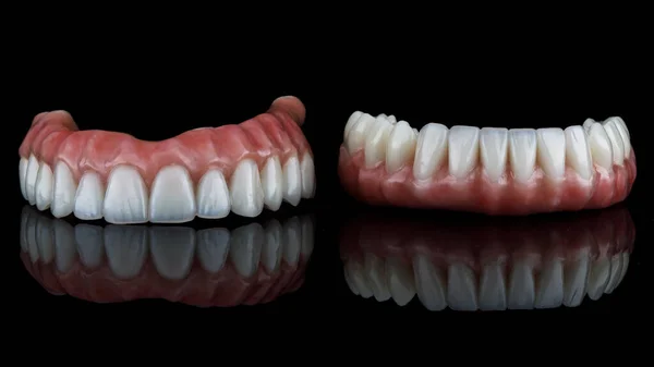 Два Зубных Протеза Нижней Верхней Челюстей Черном Фоне Идеальным Отражением — стоковое фото