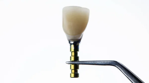 Зубна Коронка Після Моделювання Трансфер Перед Установкою Пацієнта — стокове фото