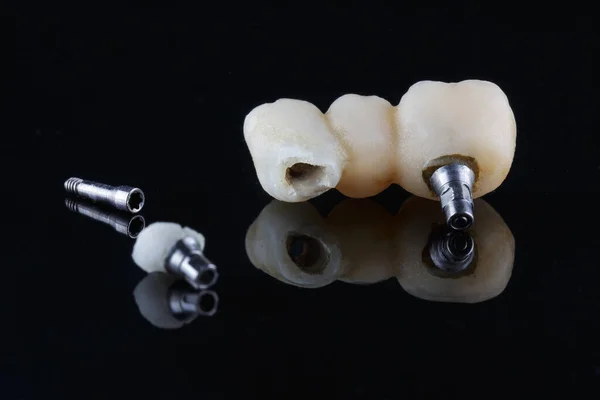 Corona Dental Con Estructura Rota — Foto de Stock