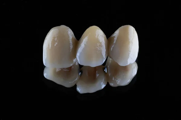 Corone Dentali Nastoschee Colore Naturale Tre Unità — Foto Stock