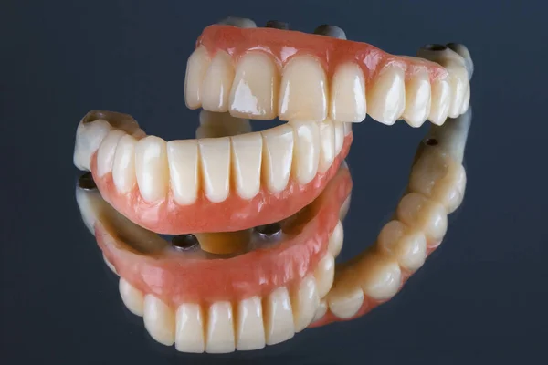 Próteses Dentárias Cerâmica Suplementadas Com Gengivas Artificiais — Fotografia de Stock