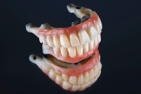 鏡の上の高品質の歯科用義歯 — ストック写真