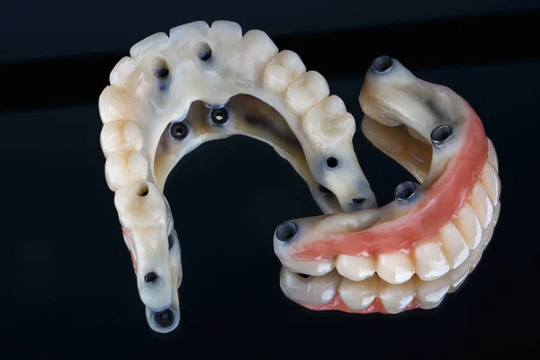 Conjunto Prótesis Dentales Alta Calidad Para Pacientes Esfera Ortopédica —  Fotos de Stock