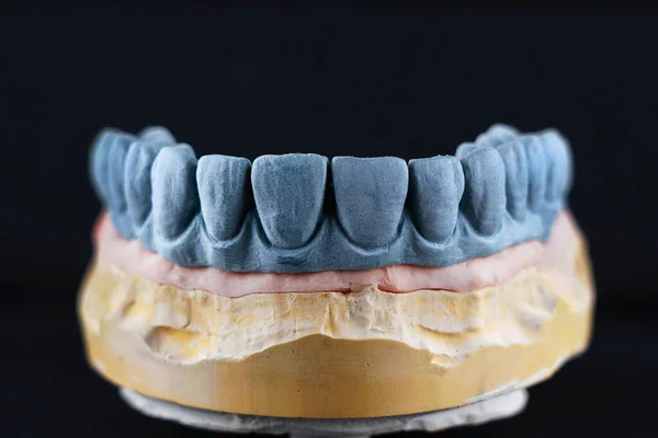 Modelo Cera Dental Del Escaneo Para Trabajar Laboratorio Dental —  Fotos de Stock