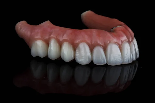 Excelente Prótese Dentária Para Mandíbula Superior Vidro Preto Com Reflexão — Fotografia de Stock