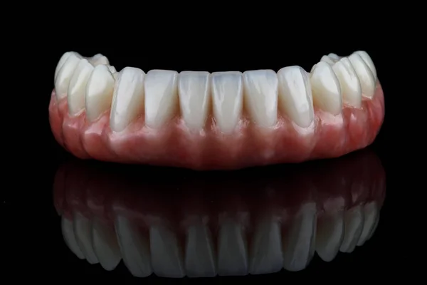 Beautiful Dental Lower Jaw Prosthesis Pink Gum Black Glass Reflection — Stock Photo, Image