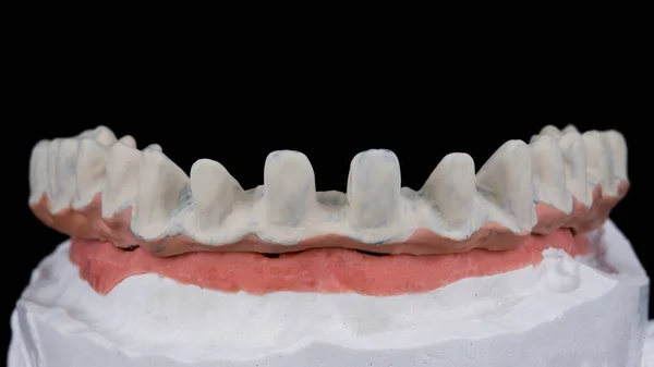 人工ガムで歯のモデルを攻撃するチタンビーム — ストック写真